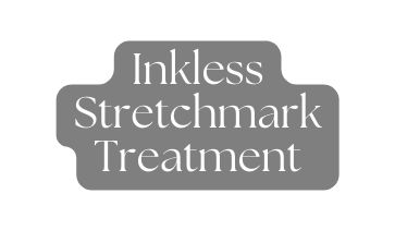 Inkless Stretchmark Treatment